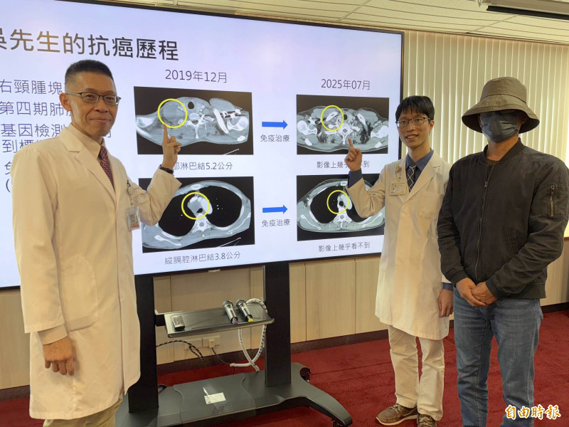 第四期肺腺癌奇蹟逆轉 物流司機靠免疫療法存活6年 腫瘤幾乎看不見